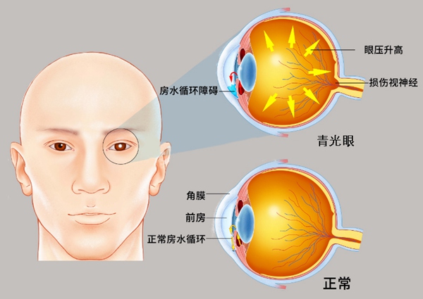 111852317.jpg afbda5ef16a147e9aacbf02ff94040fd.jpg