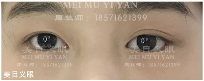 172458952.jpg 10af882a524d47b2906fdc596bfd4491.jpg